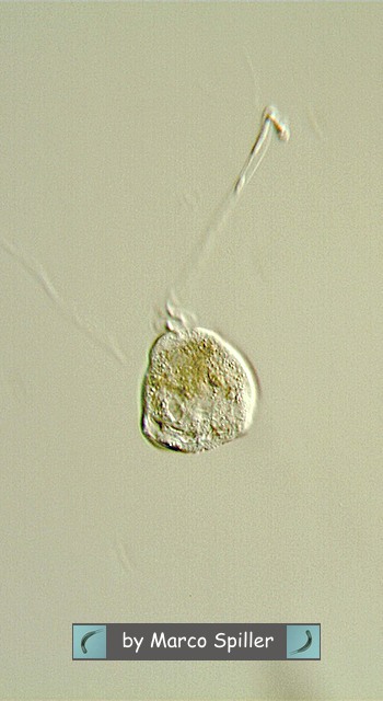 Vorticella.....e se fosse 